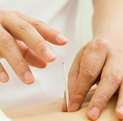 たしろ鍼灸院の施術風景